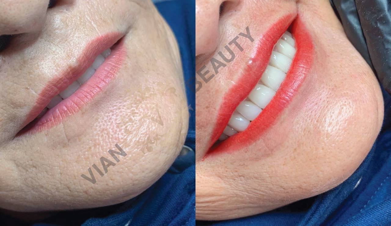 So Sanh Phun Moi Collagen Va Ombre Chi Tiet Nhat 4