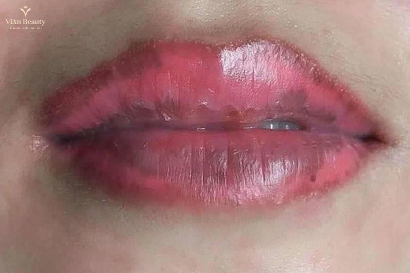 Xoa Sua Moi Cu Tra Lai Nen Moi Tu Nhien Vian Beuaty 1