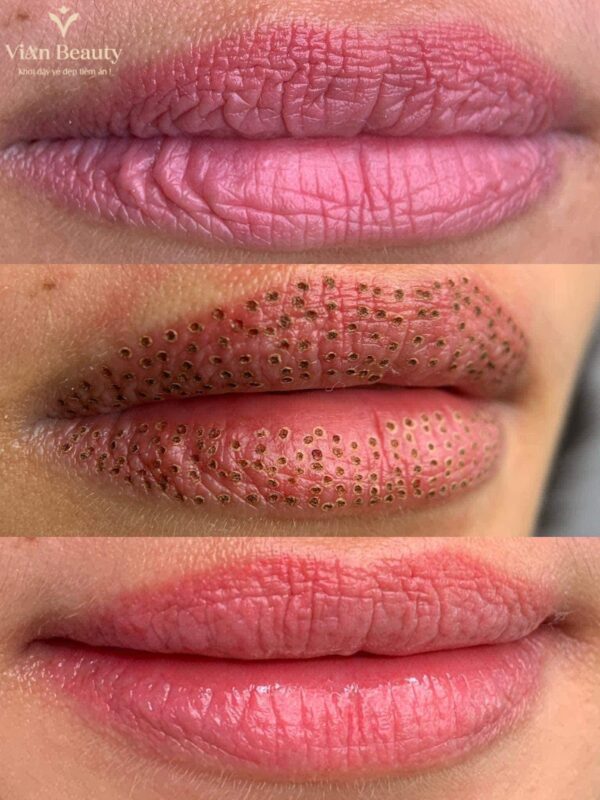 Xoa Sua Moi Cu Tra Lai Nen Moi Tu Nhien Vian Beuaty 4