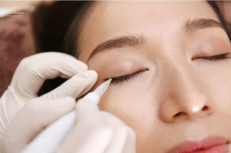 Đối Tượng Không Nên Phun Mí Eyeliner