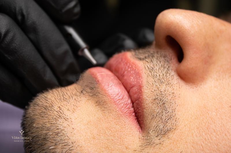 Quy Trình Phun Môi Nam