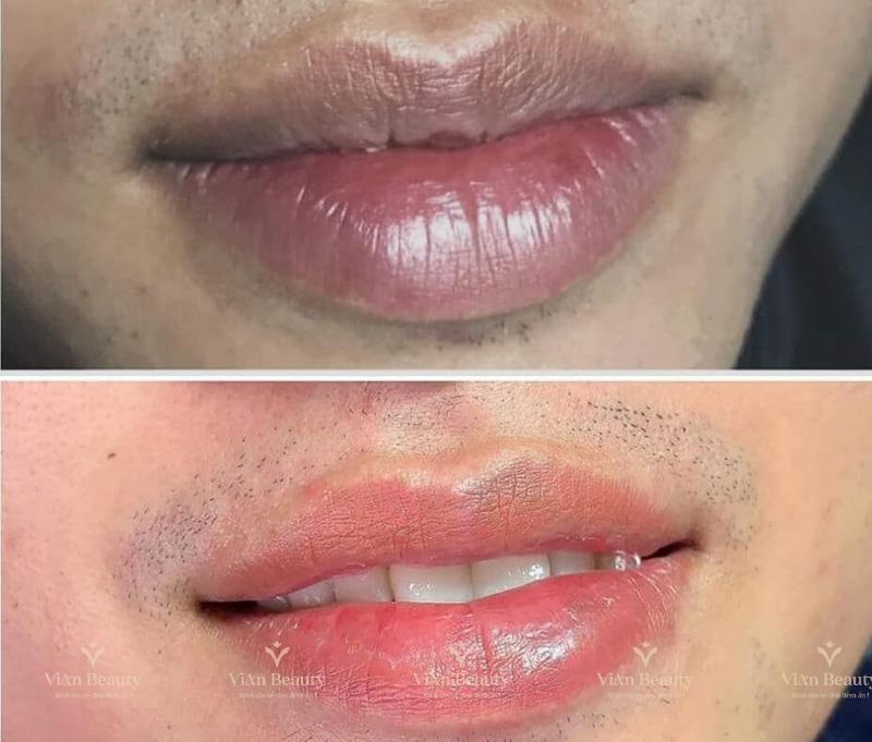 Phun Moi Nam Gioi Co Nen Khong 2