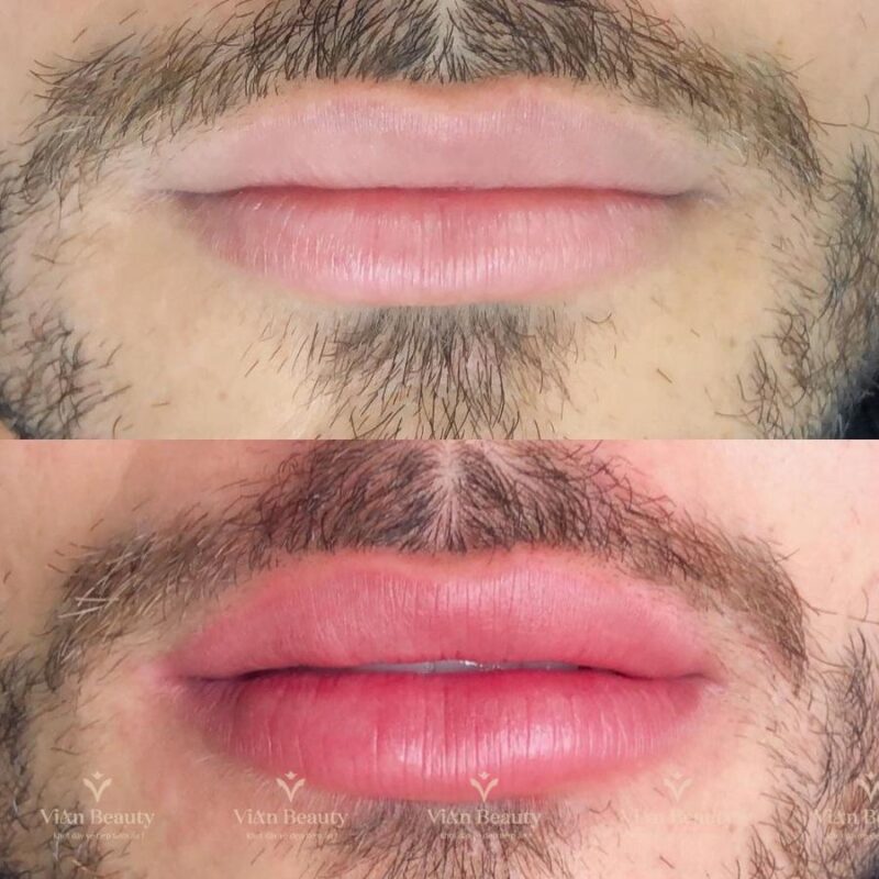 Phun Moi Nam Gioi Co Nen Khong 3