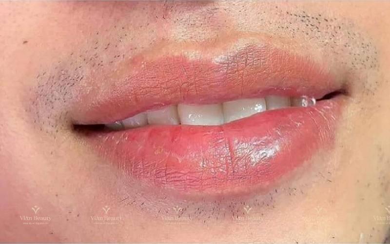 Phun Môi Nam Giới Đòi Hỏi Kỹ Thuật Và Màu Môi Tự Nhiên Hơn