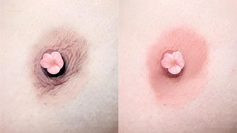 Quy Trình Phun Nhũ Hoa