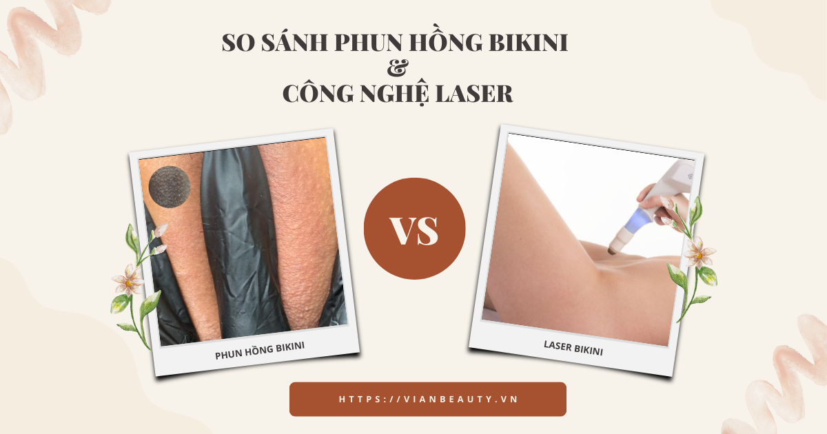 So Sánh Phun Bikini Vs Laser