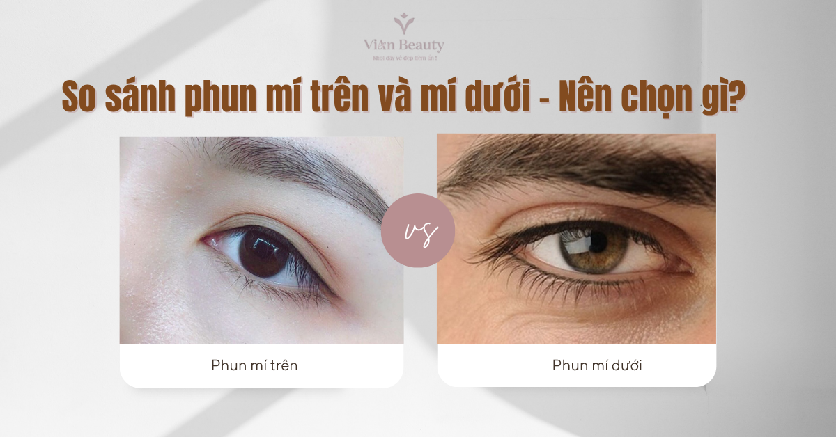 So Sánh Phun Mí Trên Và Mí Dưới